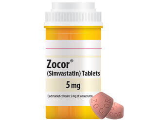 zocor